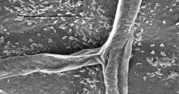 Μυκηλιακές υφές του μύκητα Oidium sp., 1-2 λεπτά μετά την εφαρμογή του Armicarb