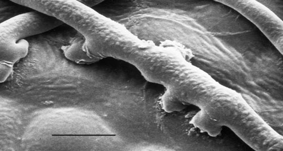 Μυκηλιακές υφές του μύκητα Oidium sp. πριν την εφαρμογή του Armicarb