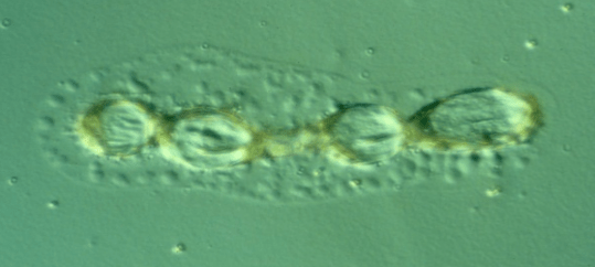 Σπόρια του μύκητα Oidium sp., 1-2 λεπτά μετά την εφαρμογή του Armicarb.